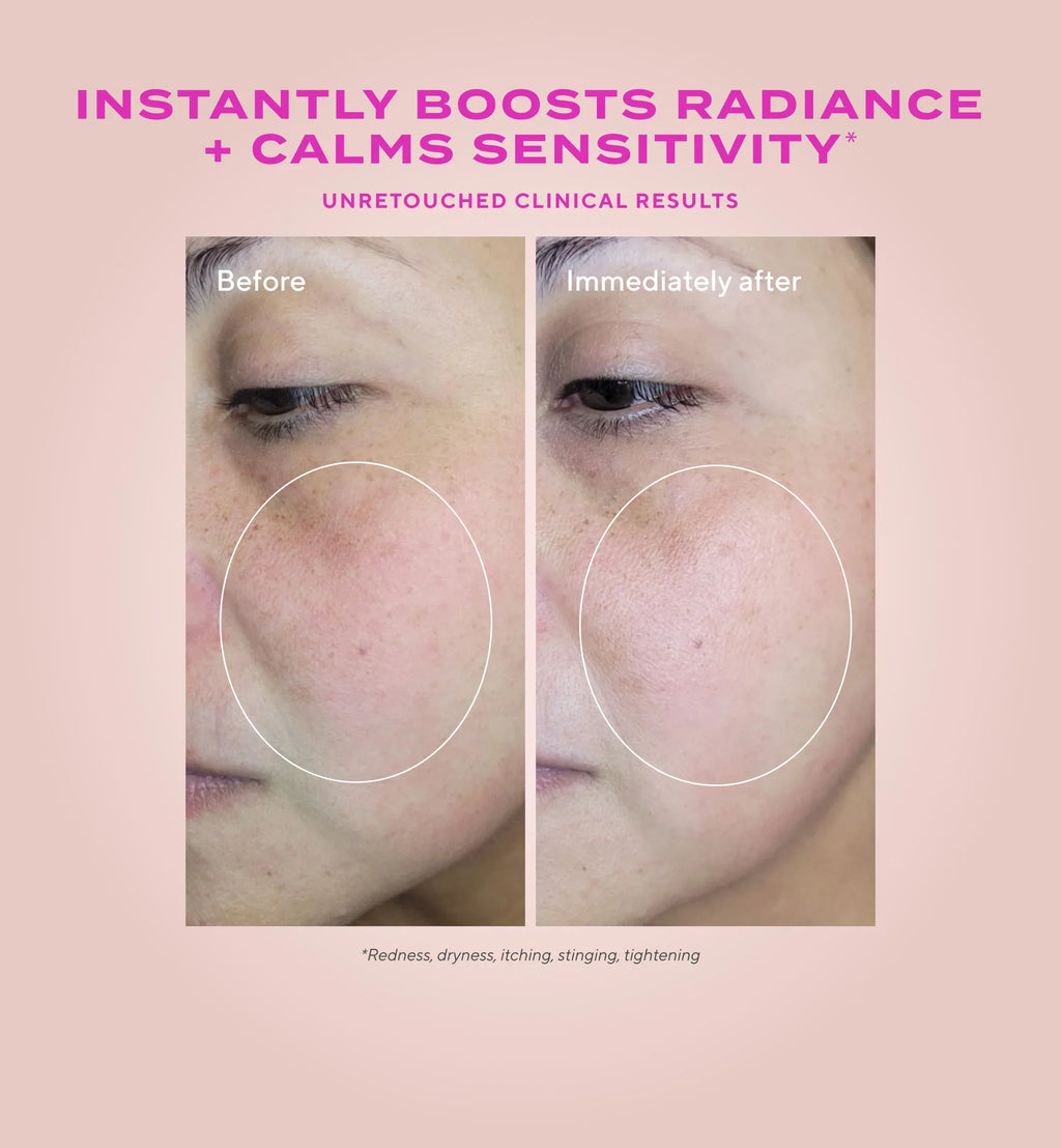 Murad HYDRATION - SENSITIVE SKIN HEARTLEAF GENTLE RESURFACING SERUM