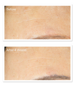 Murad RESURGENCE - RETINOL YOUTH RENEWAL NIGHT CREAM