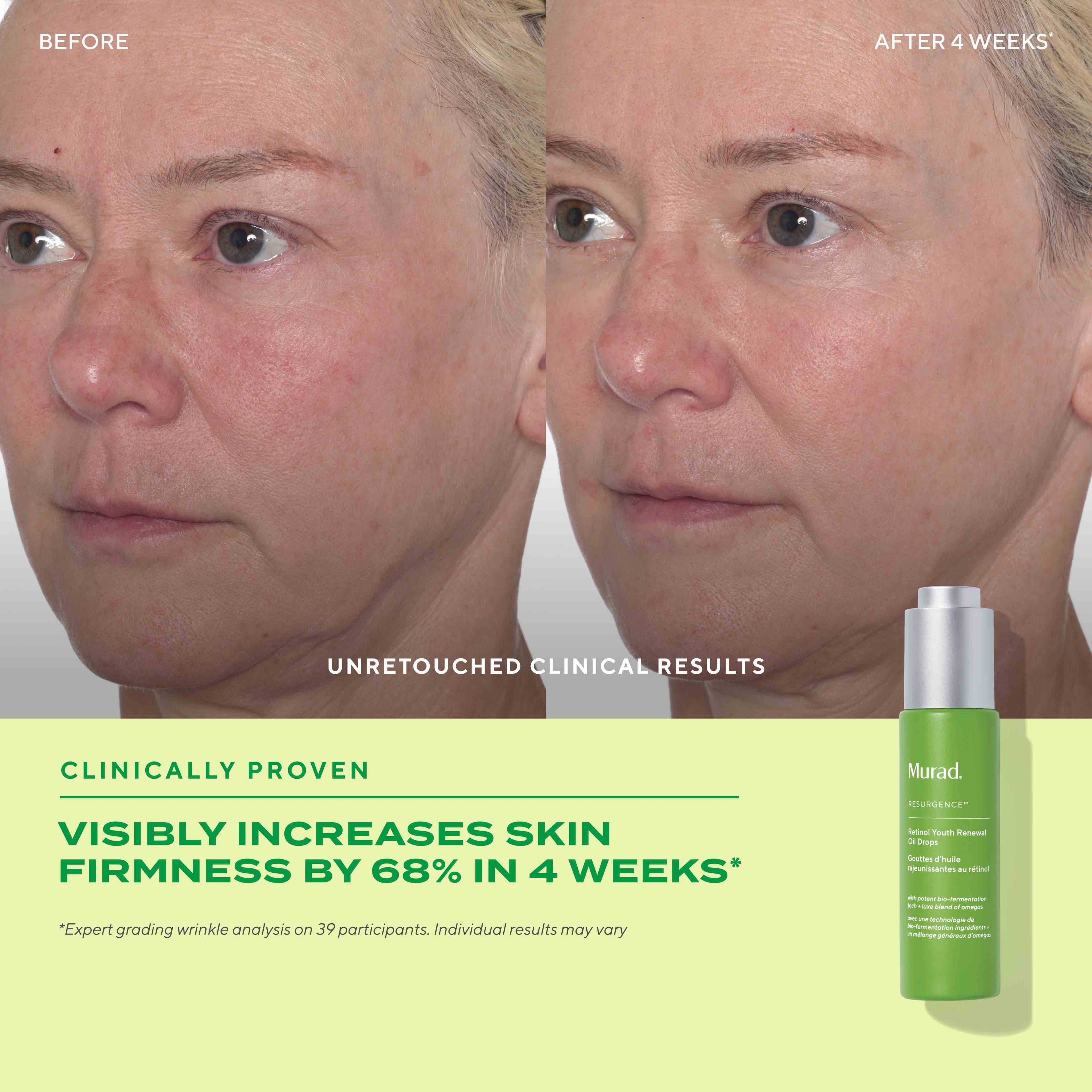 Murad RESURGENCE - RETINOL YOUTH RENEWAL OIL DROPS