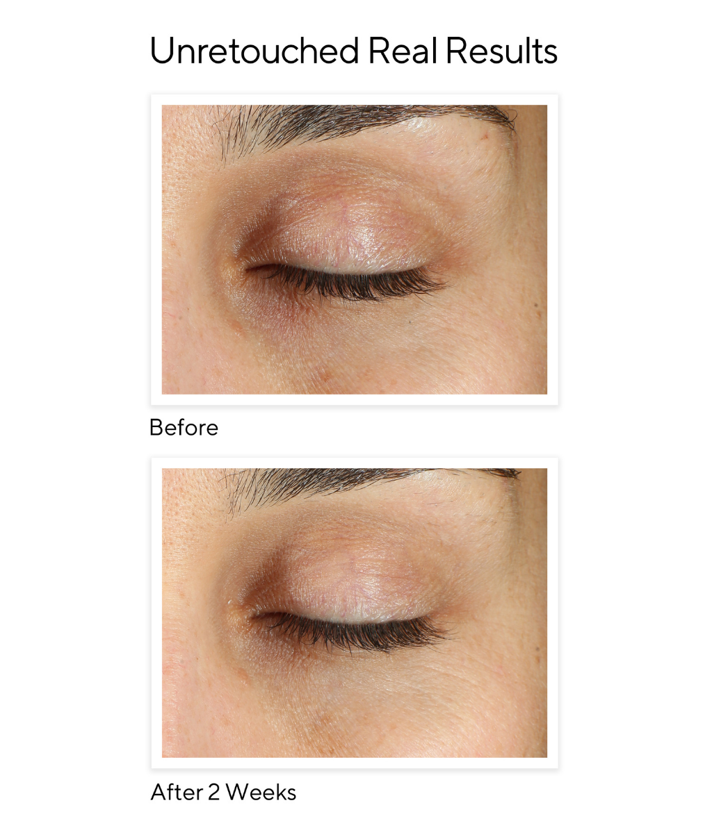 Murad E-SHIELD - VITA-C EYES DARK CIRCLE CORRECTOR