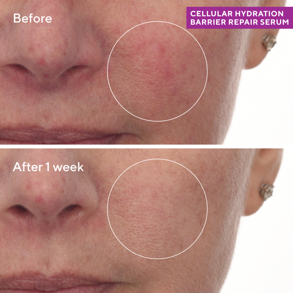 Murad HYDRATION - CELLULAR HYDRATION REPAIR SERUM