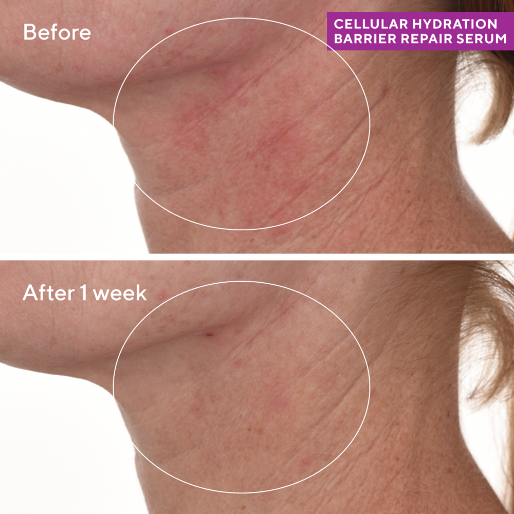 Murad HYDRATION - CELLULAR HYDRATION REPAIR SERUM