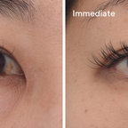 Muras´d Targeted Eye Depuffer