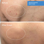 Murad BLEMISH CONTROL - RETEXTURIZING BODY PADS