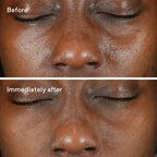 Murad BLEMISH CONTROL - RAPID RELIEF SULFUR MASK