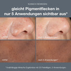 dermalogica  Power Bright Dark Spot Peel