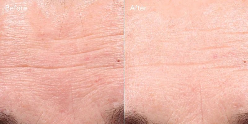 Murad RESURGENCE - RETINOL YOUTH RENEWAL SERUM