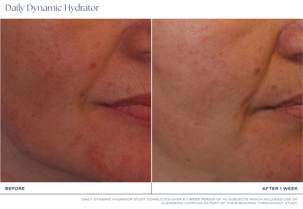 iS CLINICAL Daily Dynamic Hydrator