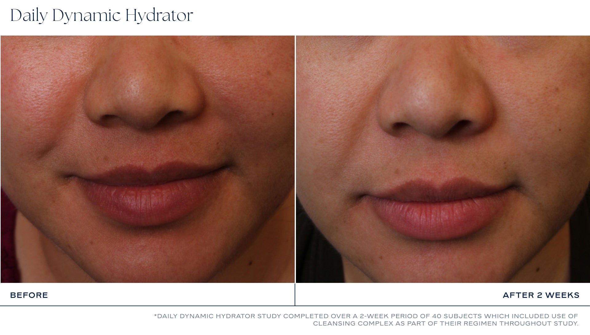 iS CLINICAL Daily Dynamic Hydrator