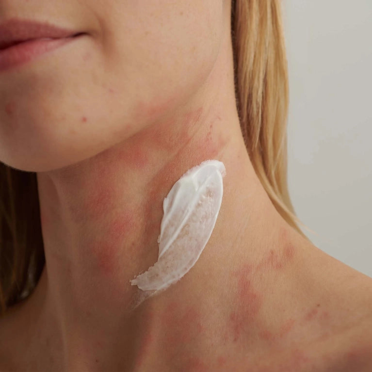 DADO SENS - EXTRODERM INTENSIVCREME