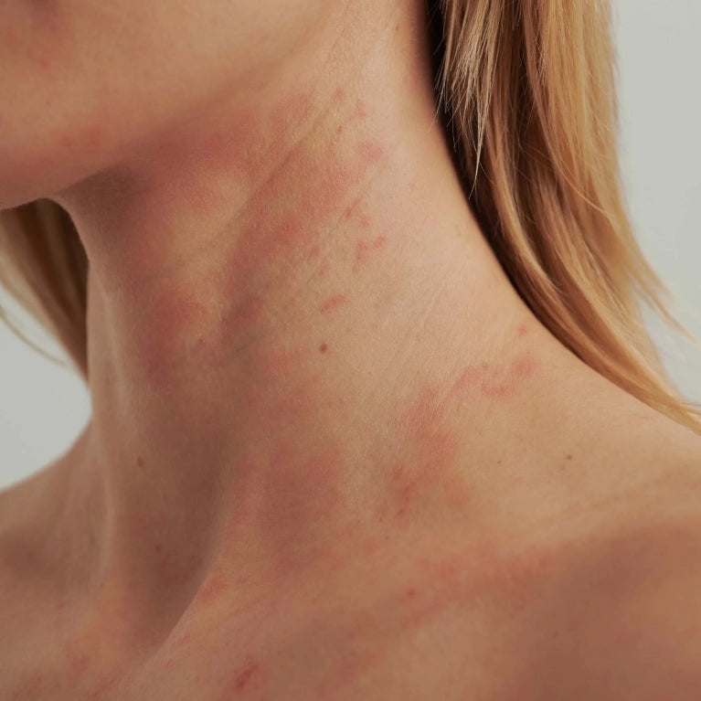 DADO SENS - EXTRODERM AUGENCREME