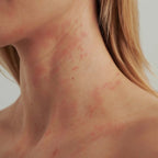 DADO SENS - EXTRODERM AUGENCREME