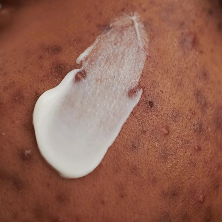 DADO SENS - PURDERM EFFEKTCREME