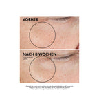 SkinCeuticals A.G.E. Advanced Eye