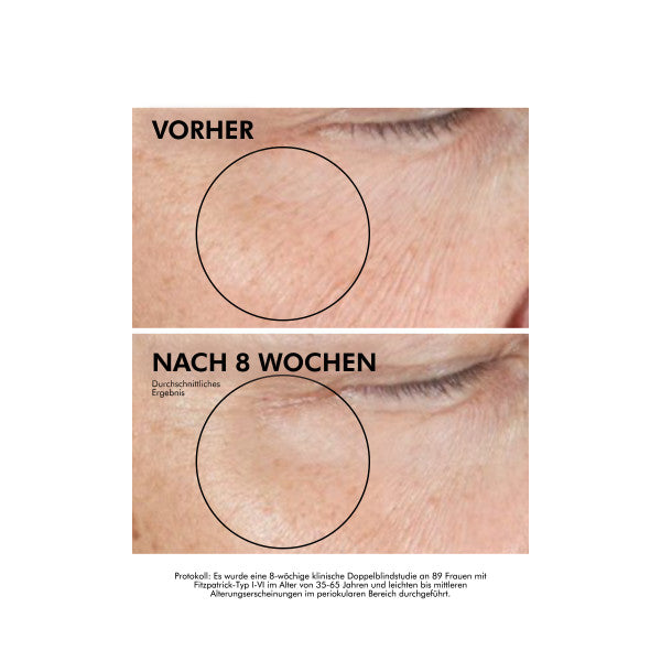 SkinCeuticals A.G.E. Advanced Eye